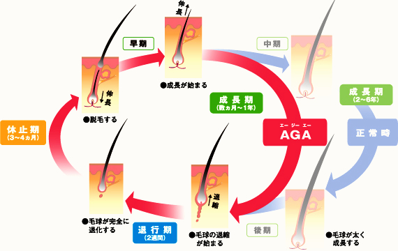 AGA（エージーエー）