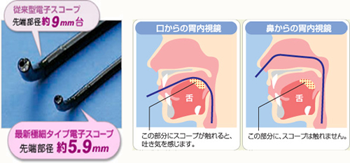 経鼻内視鏡